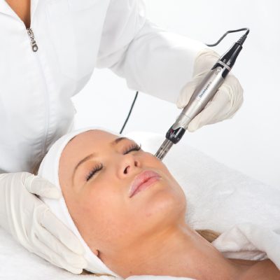 skin needling
